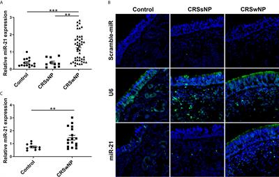 Elevated microRNA-21 Is a Brake of Inflammation Involved in the Development of Nasal Polyps